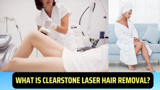 What is Clearstone Laser Hair Removal [upl. by Mosa]