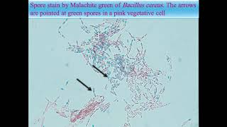 SporeForming GramPositive Bacilli Bacillus and Clostridium Species [upl. by Austen]