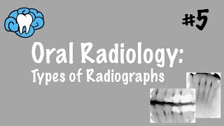 Oral Radiology  Types of Radiographs  INBDE ADAT [upl. by Raquela]