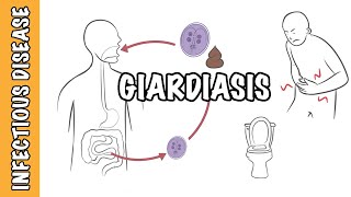 Giardiasis  Giardia Lamblia Giardia intestinalis Giardia duodenalis infection [upl. by Akilak]