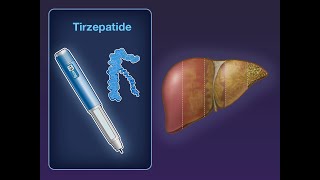 Tirzepatide for MASH with Liver Fibrosis  NEJM [upl. by Witha]