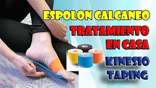 Tratamiento de espolón y fascitis plantar en casa con kinesio cinta [upl. by Andre]