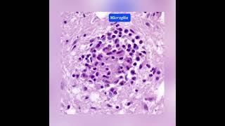 Macrophages in histopathologyhistopathology pathologists giantcell pathology microscopic [upl. by Ahsiele]