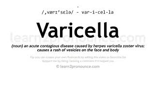 Varicella pronunciation and definition [upl. by Briggs916]