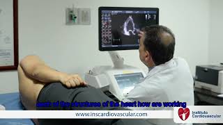 Transthoracic Echocardiogram [upl. by Iorgos297]