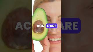 3 incredible health benefits of AVOCADO [upl. by Kaltman]