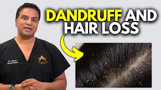 Can Dandruff Cause Hair Loss [upl. by Maddie]