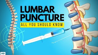 Lumbar Puncture Everything You Need to Know [upl. by Etennaej]