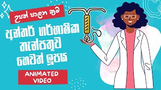 LOOP  IUCD  Contraceptive Device  IUD Sinhala video  අන්තර් ගර්භාෂික තැන්පතුව හෙවත් ලූපය [upl. by Nioe]