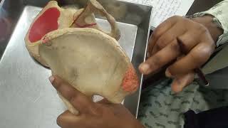 Hip bone anatomy demoin bangla [upl. by Woodley]