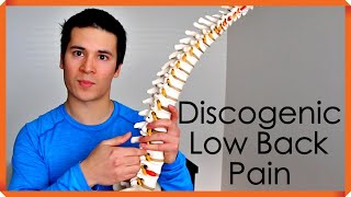 Diagnosis and Treatment of Discogenic Low Back Pain [upl. by Rebmak]