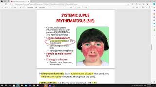 lec 5 synovial fluid [upl. by Nicolea21]