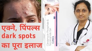 clinsol gel  clindamycin phosphate and nicotinamide gel  कील मुहांसे और पिंपल्स के लिए [upl. by Joye]