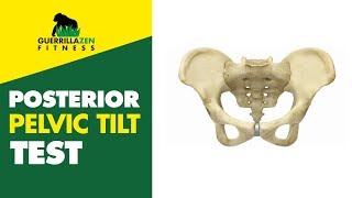 Posterior Pelvic Tilt Test  Do this one at home easily [upl. by Lyrak]