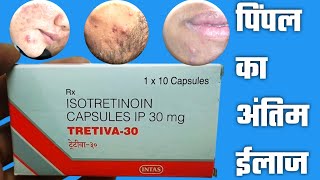 Tretiva30mg Capsule  Isotretinoin Capsule 30mg  Tretiva 30mg Capsule Uses Benefits Dosage tretiva [upl. by Aivul]