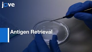 Antigen Retrieval to identify Cell types during Neurogenesis  Protocol Preview [upl. by Richer794]