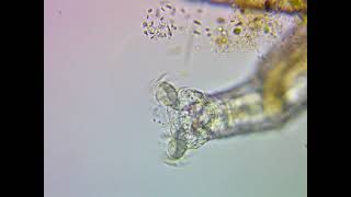 Rotifers Head and Cilia  Close View Under a Microscope [upl. by Isiad]