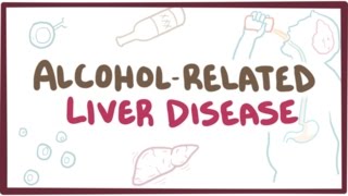 Alcoholrelated liver disease  causes symptoms amp pathology [upl. by Nomde]