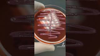 Klebsiella pneumoniae on MacConkey agar isolated from urine culture Microbiology [upl. by Akinehs639]