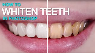 How to Whiten Teeth in Photoshop [upl. by Amalee664]