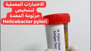 الاختبارات المعملية لتشخيص جرثومة المعدة Lab Tests for Diagnosis of Helicobacter pylori [upl. by Otreblasiul]