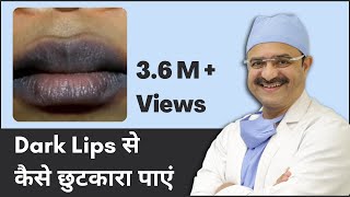 Dark Lips Treatment How to Get Rid of Dark Lips Dark Lips से कैसे छुटकारा पाएं  In HINDI [upl. by Berstine563]