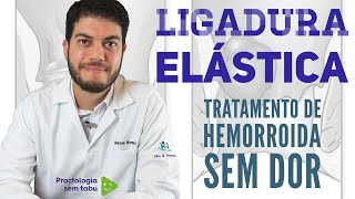 Ligadura elástica de hemorroida você conhece esse tratamento Tratamento para hemorroida interna [upl. by Chalmers]