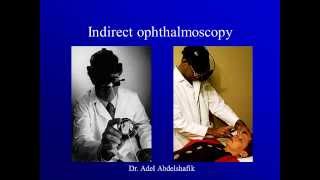 Optics course new Indirect Ophthalmoscopy [upl. by Lleddaw]