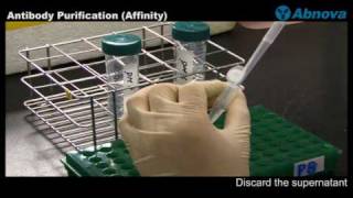 Antibody Purification Affinity [upl. by Lotsirk]