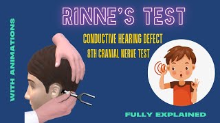 Rinne test conductive deafness and air amp bone conduction  8th cranial nerve CNS examination [upl. by Anamor]