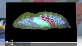 Inside the Cocoon 3D Views of a Butterflys Metamorphosis [upl. by Suhpoelc959]