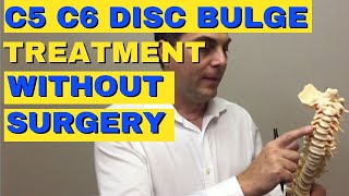 C5 C6 Disc Bulge Treatment Without Surgery  Bulging Disc C5 C6  Dr Walter Salubro [upl. by Anilehcim]