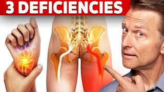 The 3 Vitamin Deficiencies in Sciatica and Carpal Tunnel Syndrome [upl. by Maer]