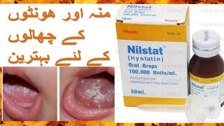 Nilstat  nystatin  oral drops  Uses and side effects in urdu and hindi [upl. by Chariot]