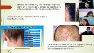 Micosis cutaneas y dermatofitas [upl. by Miehar975]