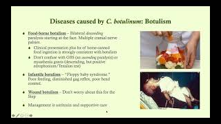 Clostridium botulinum Botulism  Microbiology Boot Camp [upl. by Shriner71]