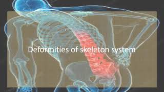 Joints and Deformities of Skeleton Lecture  18 [upl. by Gereron]