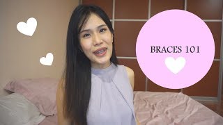 Braces 101 My Braces Journey So Far  Extractions Cost Pain Types of Braces etc [upl. by Manolo392]