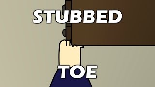 Stubbed Toe [upl. by Abrahan]