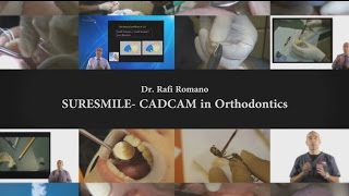 Dr Rafi Romano  Suresmile CADCAM in orthodontics [upl. by Retep]