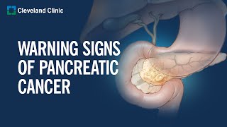 6 Warning Signs of Pancreatic Cancer [upl. by Neeoma]