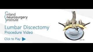 Lumbar Discectomy [upl. by Kore990]