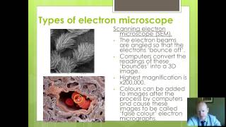 OCR Biology 1 Microscopes Part 2 [upl. by Lali416]