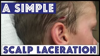 A Sunday Scalp Laceration [upl. by Eramat828]