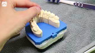 Vom Zahnarztbesuch bis zur fertigen Krone Ein Blick hinter die Kulissen bei Flemming Dental [upl. by Staci]