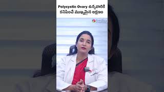 What is Polycystic Ovary  Symptoms  Causes  Dr Sumina Reddy  PCOS  Treatment  Fertilica IVF [upl. by Jamima]