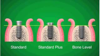 003 Straumann Dental Implant System [upl. by Rey]