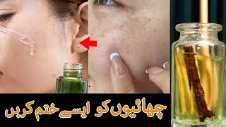 Melasma Freckles dark spots removal solution  remove melasma in 1 month  چھائیوں کو ایسے ختم کریں [upl. by Sauder]