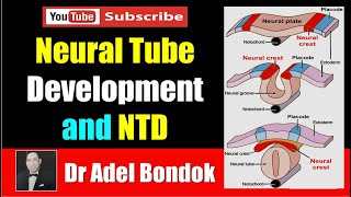 Anatomy of the Spinal Cord Dr Adel Bondok [upl. by Audrey421]