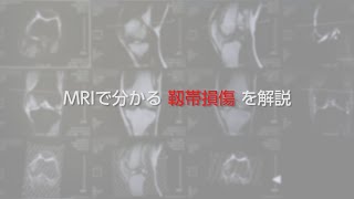 MRI画像で「靱帯損傷」をドクターが解説します。 [upl. by Notgnirra]